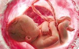 هیچ پزشکی با انجام تست غربالگری پیشنهاد سقط جنین نخواهد داد