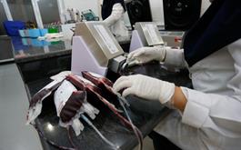 کاهش ۳۰ درصدی اهدای خون تهرانی‌ها در شب‌های قدر امسال