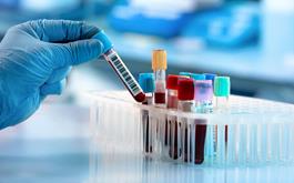 تست های PCR مبنای تشخیص قطعی کرونا در کشور