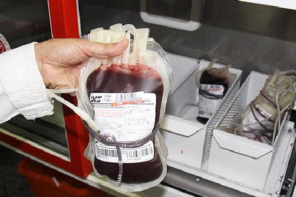 راهکار کاهش مصرف خون و فرآورده های خونی در کشور