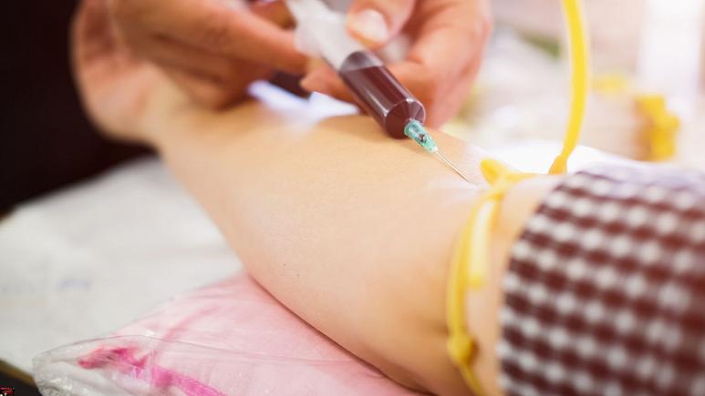 یک زن مبتلا به اچ‌آی‌وی با پیوند سلول‌های خون بند ناف درمان شد
