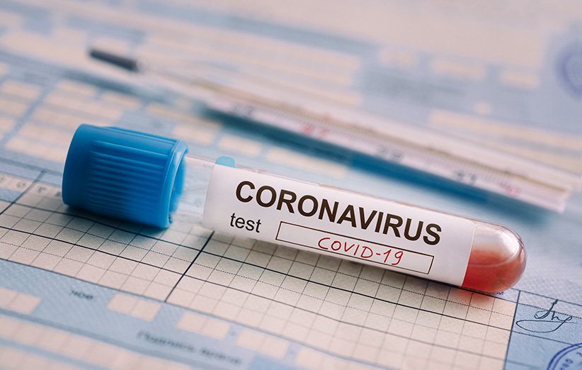 ضرورت پرهیز از بکارگیری تست های تشخیص سریع کرونا بدون تبادل داده با نظام بهداشتی 