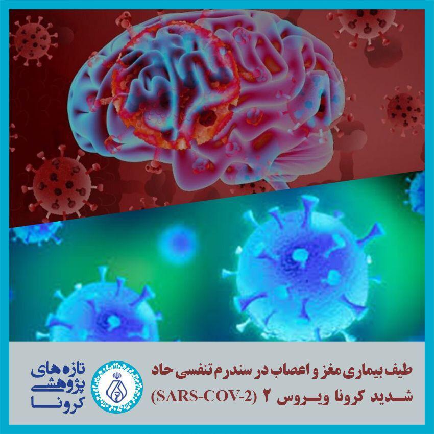 طیف بیماری مغز و اعصاب در سندرم تنفسی حاد شدید کرونا ویروس-۲ 